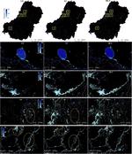 Can we detect more ephemeral floods with higher density harmonized Landsat Sentinel 2 data compared to Landsat 8 alone?